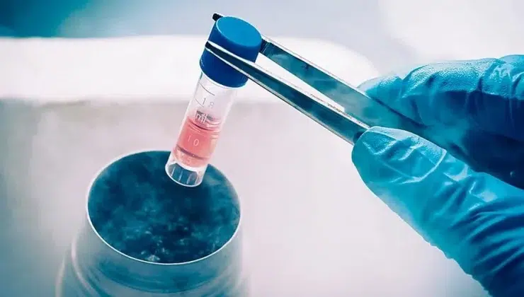 stem cell preserve
