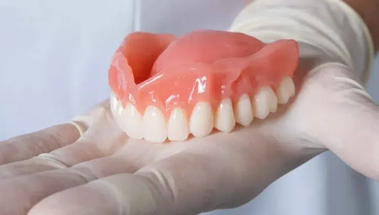 Flexible Denture