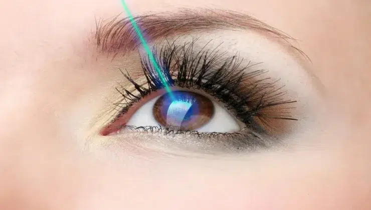 Lenses
