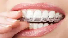Oral Health