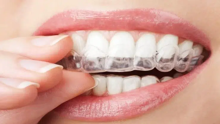 Oral Health