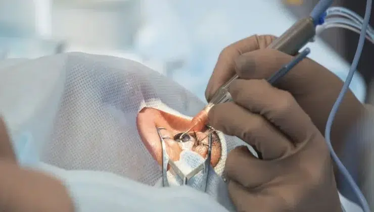 Surgery
