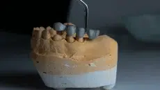 Dental Problem