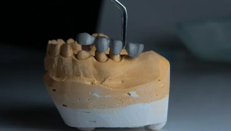 Dental Problem