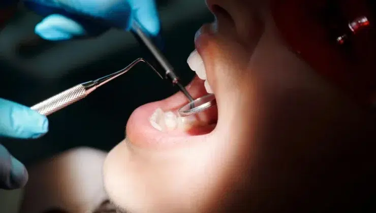 Dental Health