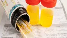 Urine Tests