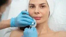 Makes Belotero