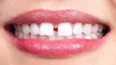 Teeth