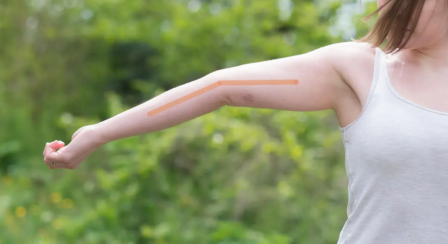 23 Signs You Grew Up With Ehlers-Danlos Syndrome